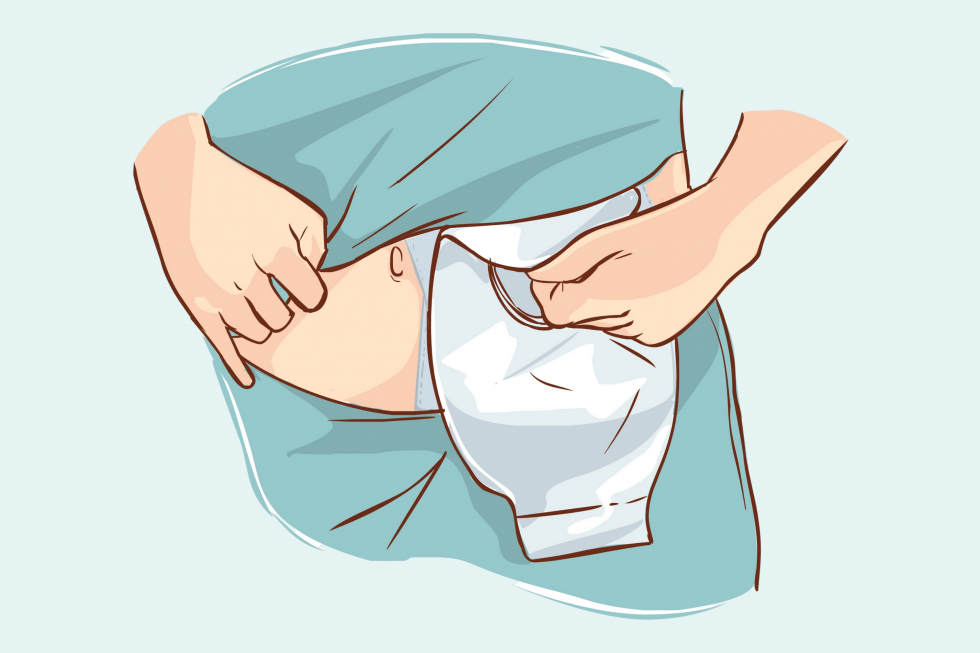 How To Change Stoma Bag? A Step-By Step Tutorial Video.