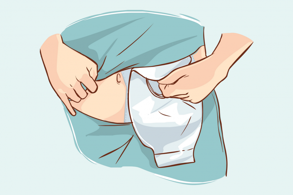 How To Change Stoma Bag? A StepBy Step Tutorial Video. SM Health Care
